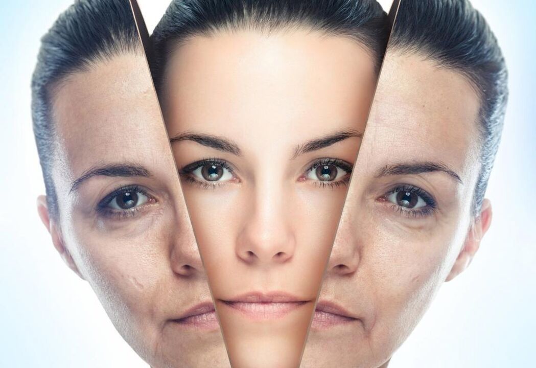 facial rejuvenation methods