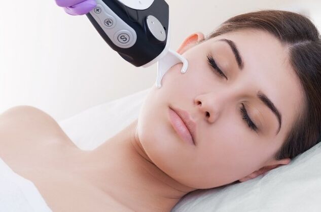 Adaptation after laser rejuvenation