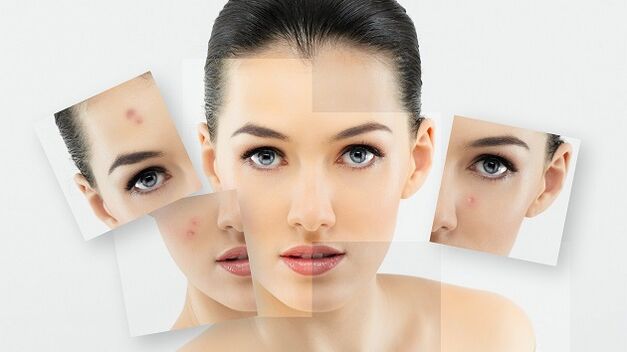 what skin problems does laser rejuvenation solve 