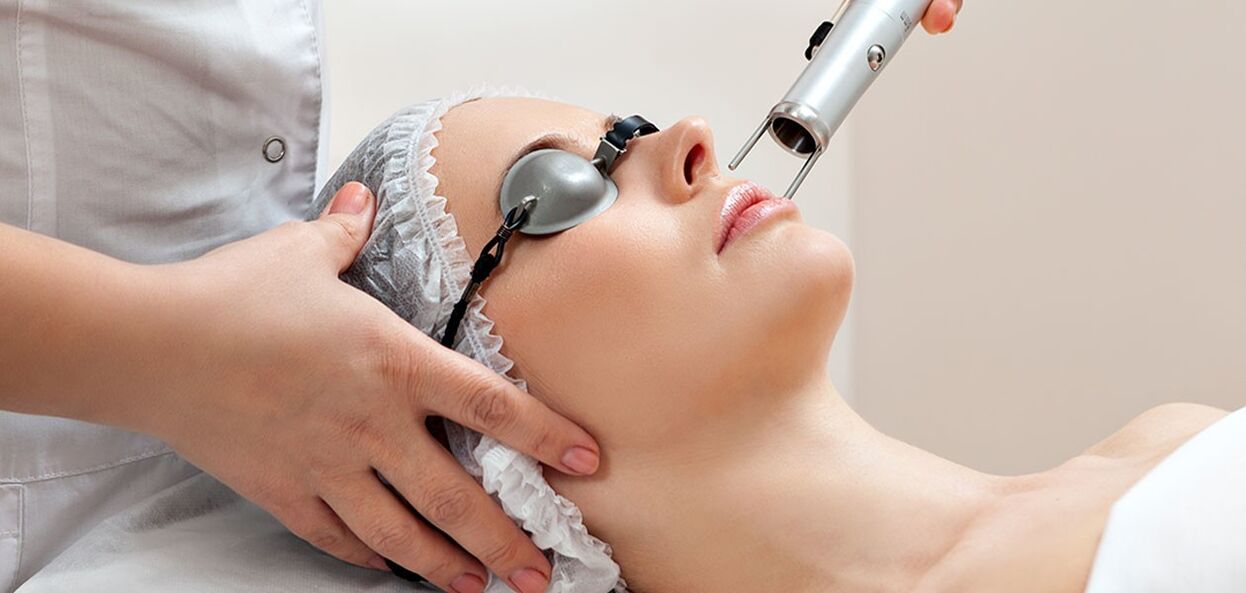 Laser peeling procedure for facial skin rejuvenation