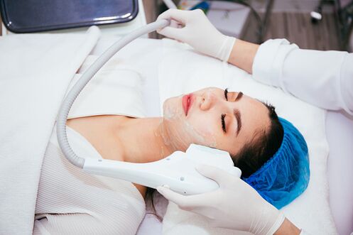laser skin rejuvenation procedure